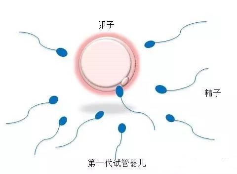 关于借卵代孕一站式服务